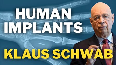 Human Implants | Klaus Schwab