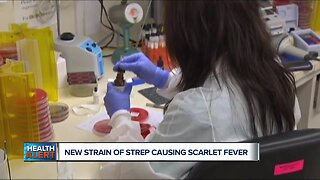 Ask Dr. Nandi: New strain of strep causing cases of scarlet fever