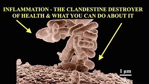Inflammation, Clandestine Destroyer of Health & What You Can Do About It, Live Q & A Bob Gilpatrick