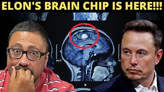 Elon Musk Just Planted A Brain Chip Into The First Human Patient!!!