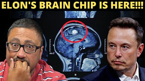 Elon Musk Just Planted A Brain Chip Into The First Human Patient!!!