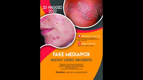 FakeMediaPox: tutte le menzogne per coprire danni del siero Pfizer