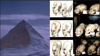 Flash Frozen Civilization found in Antarctica of Elongated Paracus Skulls