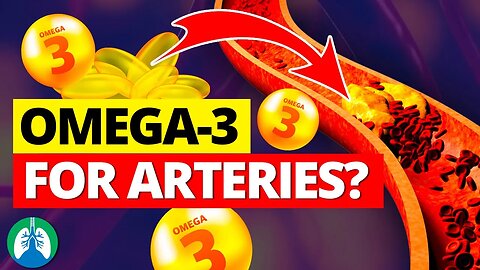 ❣️ How to Use Omega-3 to Clean Your Arteries (Lower Heart Attack Risk)