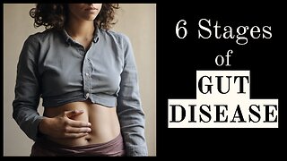 6 Stages of Gut Disease