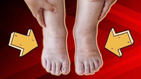 Top Causes Of Ankle Swelling & Pain (All You Need To Know)
