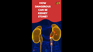 What Causes Kidney Stone? *