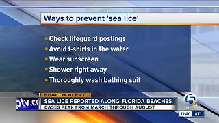 Advice on preventing sea lice