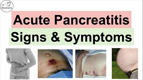 Acute Pancreatitis Signs & Symptoms (& Why They Occur)