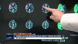 Stroke victims, doctors: Time is everything when it comes to recovery