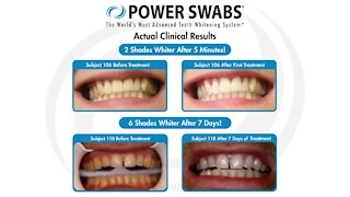 Power Swabs: Get a whiter, brighter smile in just minutes!