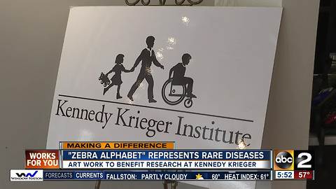 Zebra Alphabet paintings raise money, awareness about rare diseases