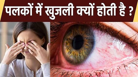 आंखों में खुजली के कारण ओर इलाज || itching in eyes causes and treatment