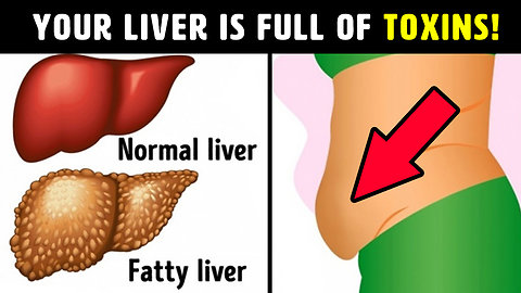 10 Warning Signs That Your Liver Is Full of Toxins
