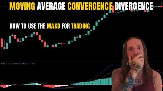 The MACD Indicator Does It All! How to Use MACD for Trading