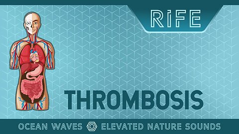 HEALING THROMBOSIS with RIFE