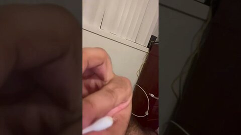 Popping pimple/cyst