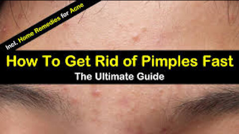 How to Get Rid of Your Acne fast 2022