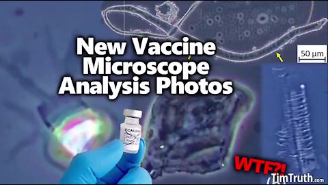 New Vaccine Microscopy Analysis