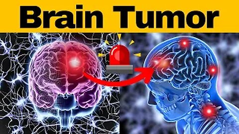 9 Warning Signs You Have A Brain Tumor - Know The Risks!