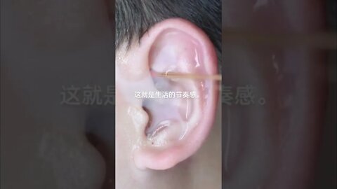 Chinese Girl's Soft Tender Ear Gets Cleaned