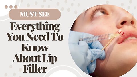 Everything You Need To Know About Lip Filler! | Barrett MedSpa