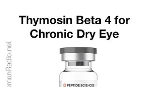 Thymosin Beta 4 for Chronic Dry Eye