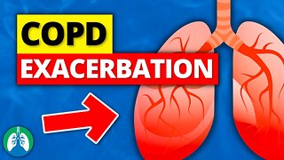 COPD Exacerbation - What is it? (Acute Symptoms) | Definition