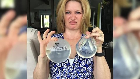 Former Detroit traffic reporter claims breast implants caused fatigue, depression and more