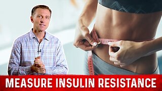 Best Way to Measure Insulin Resistance Without Blood Test – Dr. Berg
