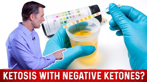 Can You Be in Ketosis Despite No Ketones in the Urine? – Dr.Berg