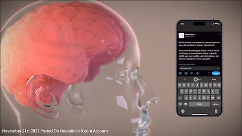 Neuralink | "Imagine the Joy of Connecting w/ Your Loved Ones, Browsing the Web Or Playing Games Using Only Your Thoughts. This Is Made Possible By Placing a Small Cosmetically Invisible Implant Into a Part of Your Brain That Controls Movements.&quot