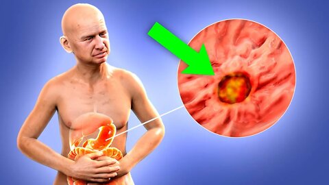 3 Stomach Pains You Should Never Ignore