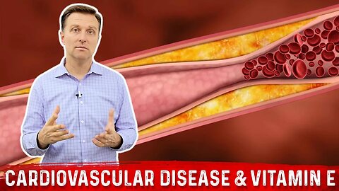 Coronary Heart Disease & Vitamin E Explained By Dr. Berg