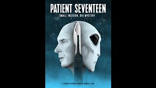 Patient SevenTeen