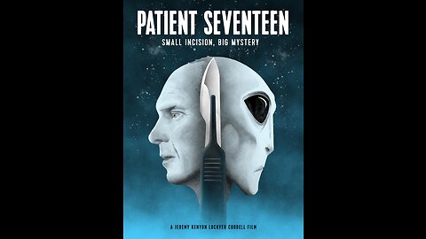 Patient SevenTeen