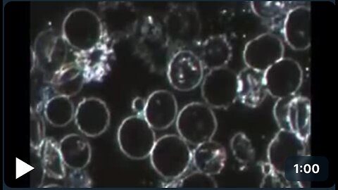 Bacteria forming in red blood cells as seen in dark field microscopy