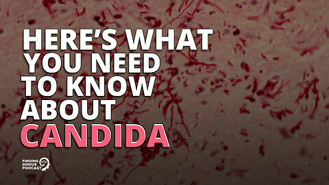 Here’s What You Need to Know About Candida