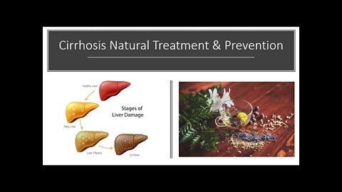 Cirrhosis Of The Liver - Natural Treatment