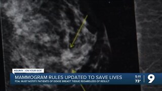FDA releases new guidelines for mammogram facilities