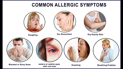 What is allergy, definition & treatment.