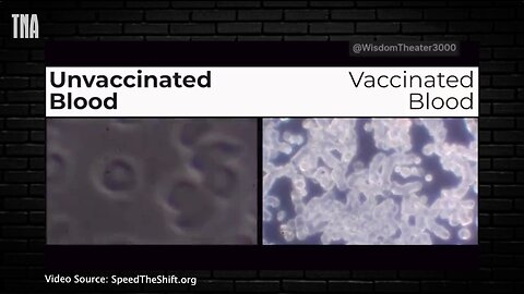 Scary Videos of What the Vaccine Does To Blood