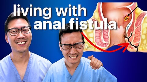 How to live with Anal Fistula!