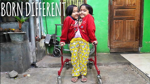 We're Conjoined Twins Who Share Legs | BORN DIFFERENT