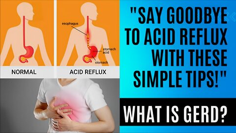 Acid Reflux: Symptoms, Causes, and Best Treatments