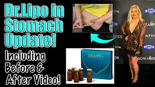 Dr.Lipo In Tummy Update, from AceCosm.com | Code Jessica10 saves you Money at All Approved Vendors