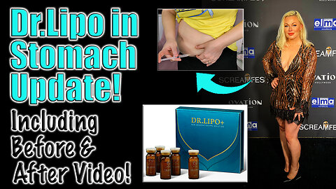 Dr.Lipo In Tummy Update, from AceCosm.com | Code Jessica10 saves you Money at All Approved Vendors