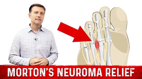 The Best Remedy for Foot Pain (Morton's Neuroma) – Dr.Berg