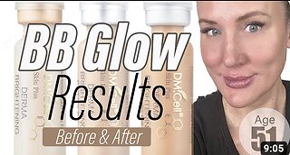 BB Glow Results // Gorgeously Aging