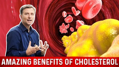 Cholesterol Function – Amazing Benefits of Cholesterol – Dr. Berg